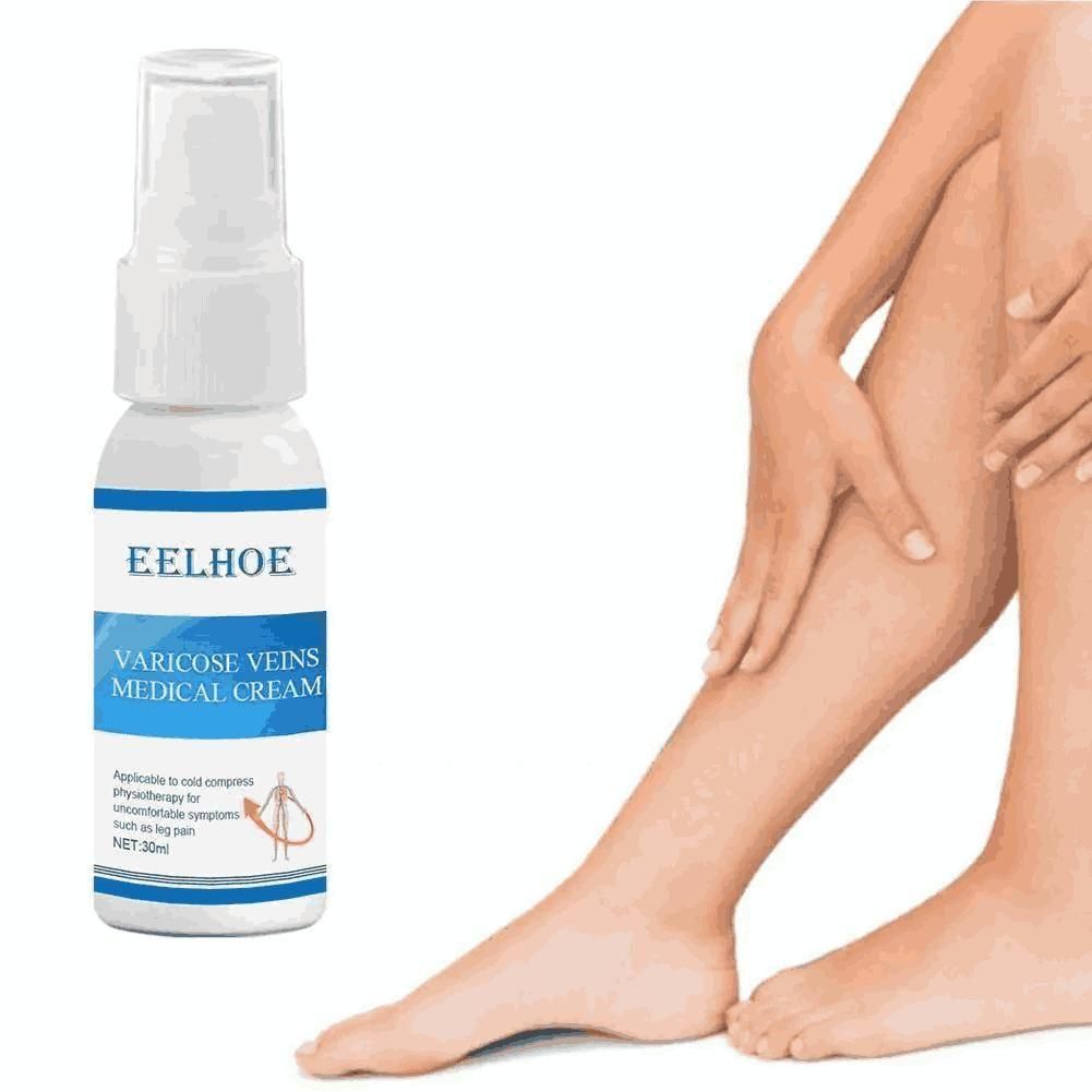 Varicose Vein Cream Spray Varicose Vein Legs and Varicose Vein Swelling