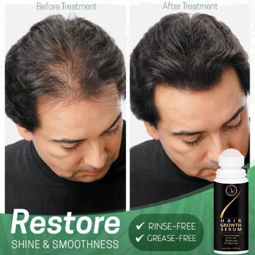 Hair growth serum