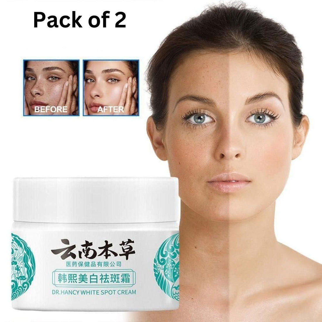 Japanese Melasma Cream (Pack of 2) Roposo Clout